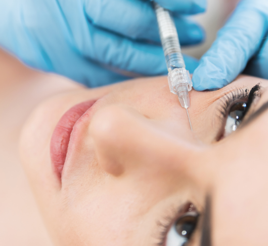 Close-up of cosmetic under-eye filler treatment