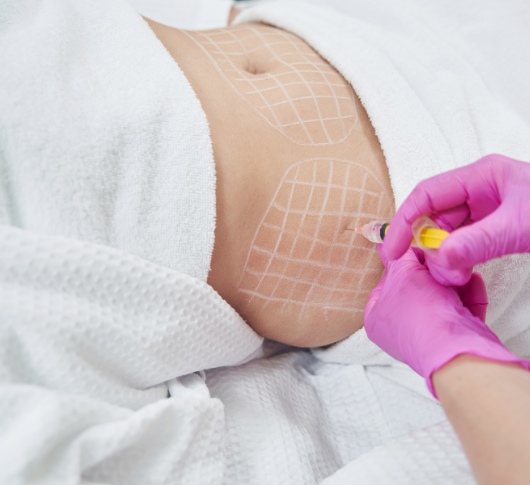 Fat reduction injection treatment
