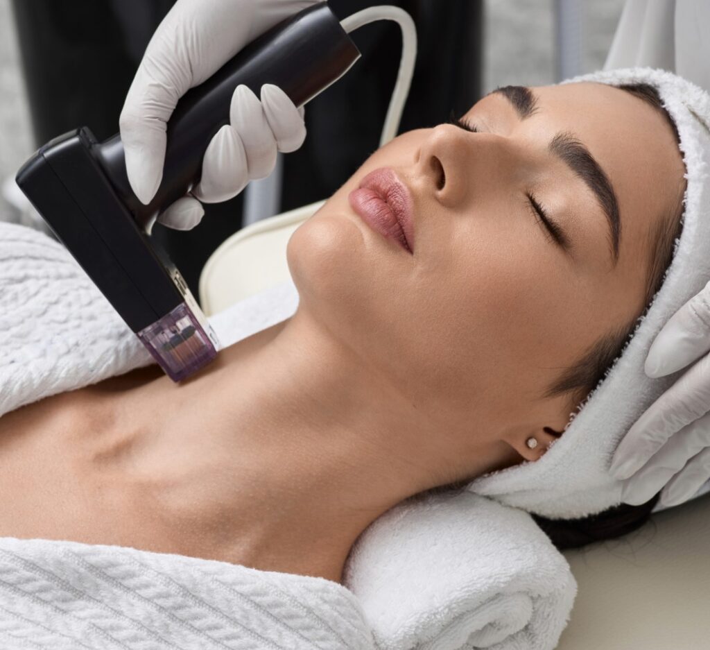 Neck Lift RF Microneedling
