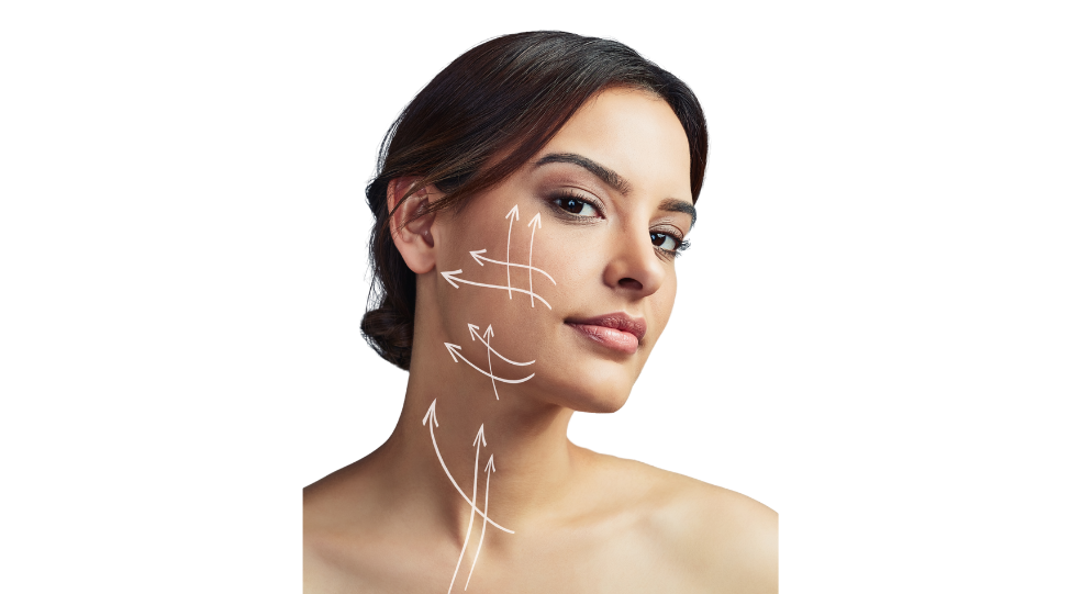 Close-up of woman’s face and neck with white directional arrows indicating facelift lift points