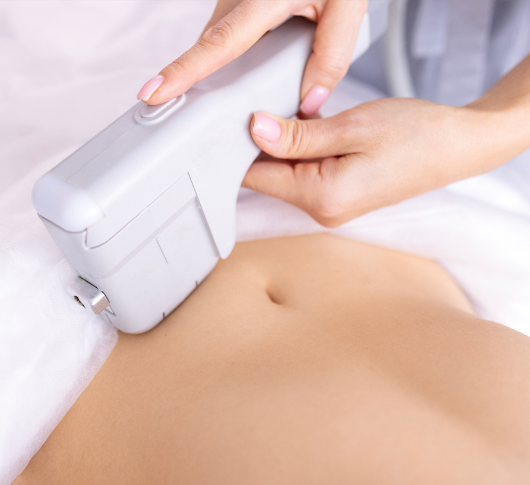 HIFU device treating abdomen for contouring